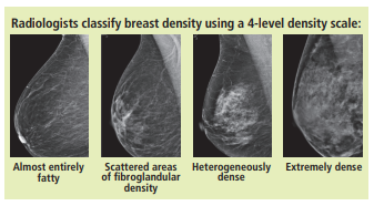 Classifications of breast density from the American College of Radiology.